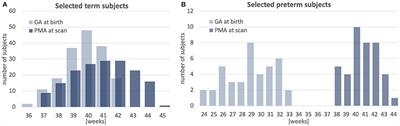 Multi-Channel 4D Parametrized Atlas of Macro- and Microstructural Neonatal Brain Development